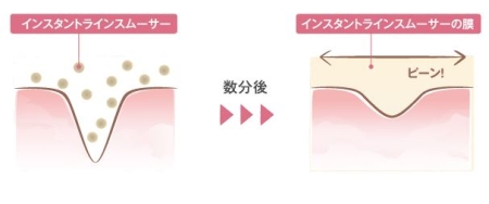 ジーニーインスタントラインスムーサー